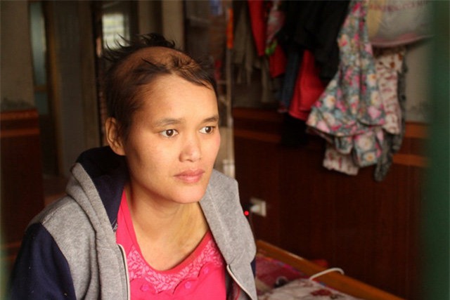 am anh cau noi cua co gai mac ung thu di can va 7 lan vuot can khong thanh - 1