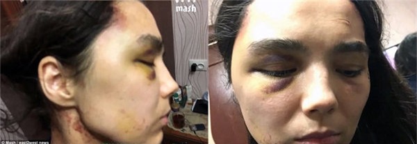 hen ho qua mang, co gai bien thanh no le tinh duc 6 nam, sinh 4 con cho "chong ho" - 2