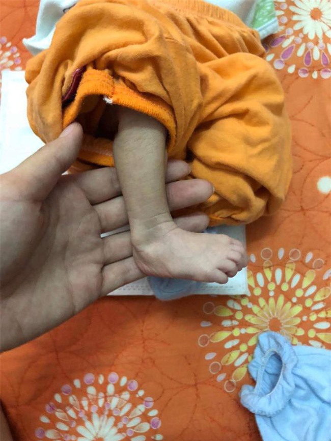 Hà Nội: Xót xa bé trai gầy teo tóp vì vừa sinh ra bị mẹ bỏ rơi mặc người nhà trông nom - Ảnh 3.