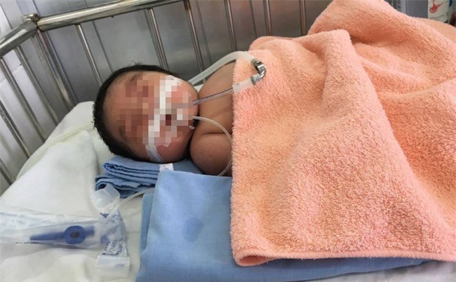 Bác sĩ chia sẻ câu chuyện: Mẹ tự tay 