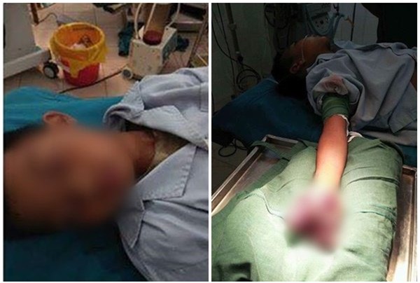 giat minh nhin lai nhung tai nan thuong tam do vua sac pin vua dung dien thoai - 3