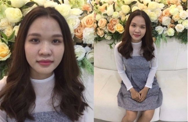 Ký ức kinh hoàng sau lần làm đẹp dại dột đến bỏng rộp cả mặt của cô gái trẻ - Ảnh 6.