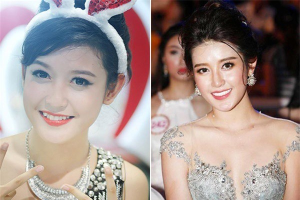 răng sứ - Ảnh 7.