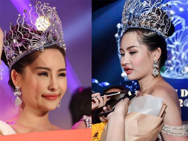 bac si bao nhan khang dinh hh dai duong chinh hinh rang, xuong ham hinh anh 3