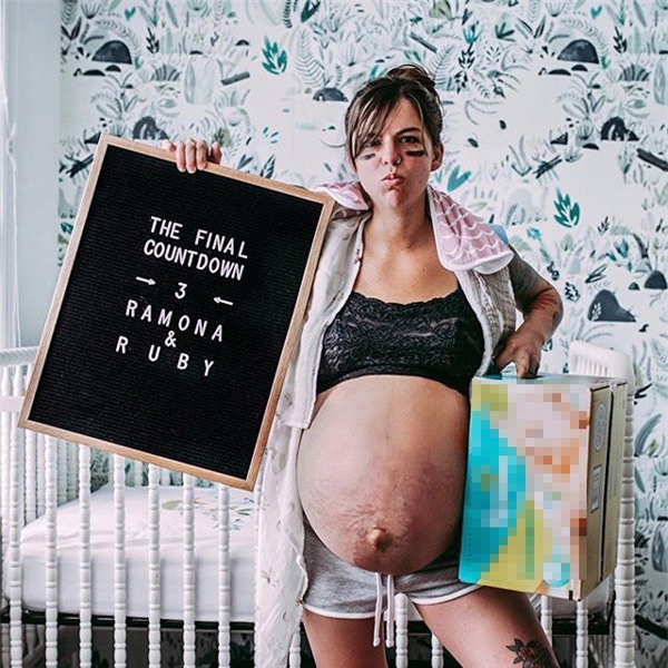 nhin vung bung "nhau nhi" sau sinh cua me, con trai lon ngac nhien: "bung me bi lam sao vay?" - 6