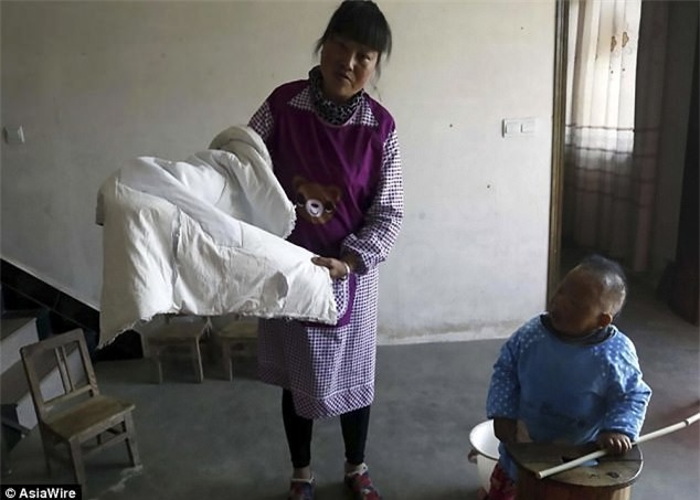 Sinh ra đứa trẻ quái dị, người đời xui vứt con đi nhưng bà mẹ vẫn một mình nuôi nấng suốt 30 năm - Ảnh 6.