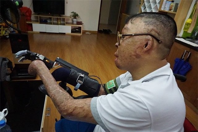 cuoc song moi cua chien si song sot trong vu truc thang roi o hn khi co ban tay gia - 11