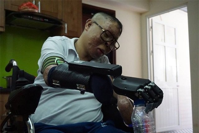 cuoc song moi cua chien si song sot trong vu truc thang roi o hn khi co ban tay gia - 2