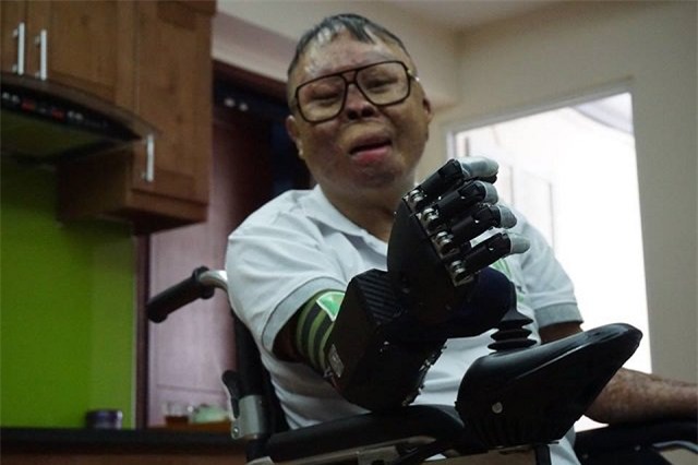 cuoc song moi cua chien si song sot trong vu truc thang roi o hn khi co ban tay gia - 7