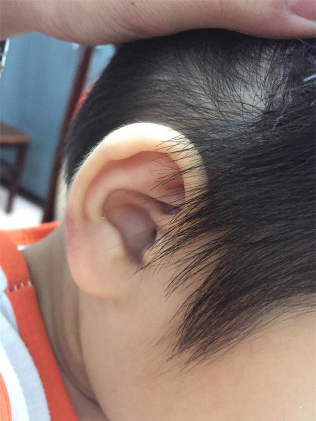 Mẹ kế bạo hành con riêng của chồng lên tiếng: Tất cả là sắp đặt, họ cố gắng để cháu làm cho em bực tức - Ảnh 1.