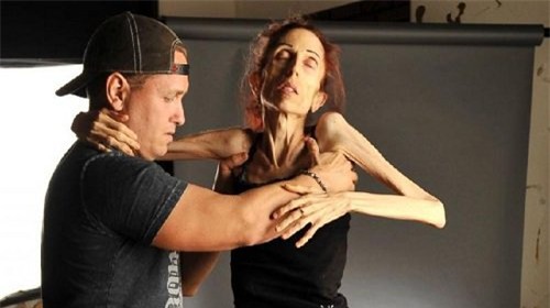 hanh trinh ngoan muc thay doi nhan sac cua co gai chi 18kg tung doi choi voi thàn chet - 5