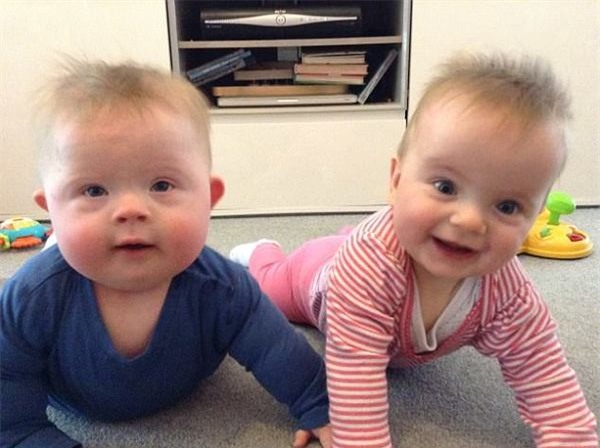 thai bi chan doan mac hoi chung down, me van kien quyet khong tu bo vi li do nay! - 3