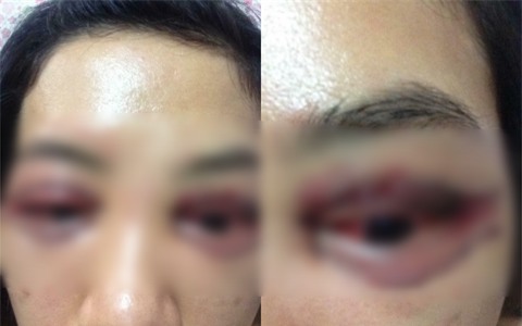 Vụ cô gái đi cắt mí mắt gây xôn xao MXH: Khi cô gái đến làm việc, chủ spa hỏi sao lại bêu xấu hình ảnh spa? - Ảnh 1.