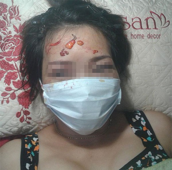 Vụ cắt mí mắt gây bão mạng: Quảng cáo rất kêu nhưng cơ sở chỉ là tiệm cắt tóc, gội đầu - Ảnh 6.