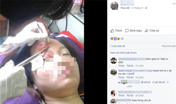 Vụ cắt mí mắt gây bão mạng: Quảng cáo rất kêu nhưng cơ sở chỉ là tiệm cắt tóc, gội đầu - Ảnh 7.