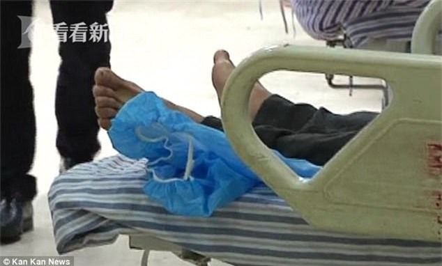 Chụp CT, bác sĩ phát hiện vật thể lạ trong bụng người đàn ông và không thể tin vào mắt mình khi lấy ra