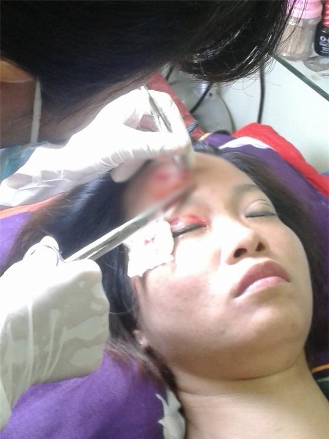 Những ca phẫu thuật thẩm mỹ khiến bệnh nhân biến dạng gây rúng động mạng xã hội-3