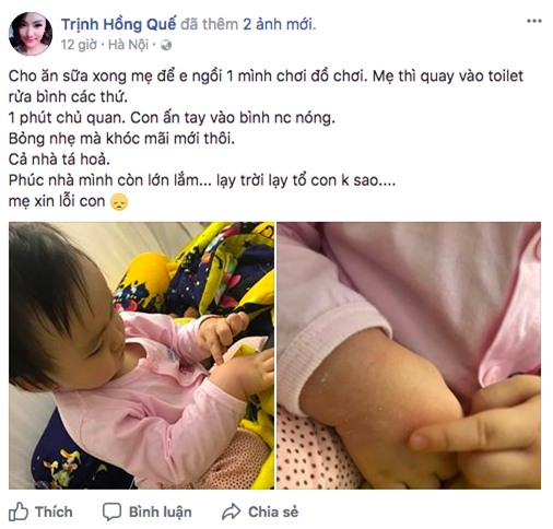 Hồng Quế tự trách móc bản thân vì một phút lơ là khiến con bị bỏng - Ảnh 1.