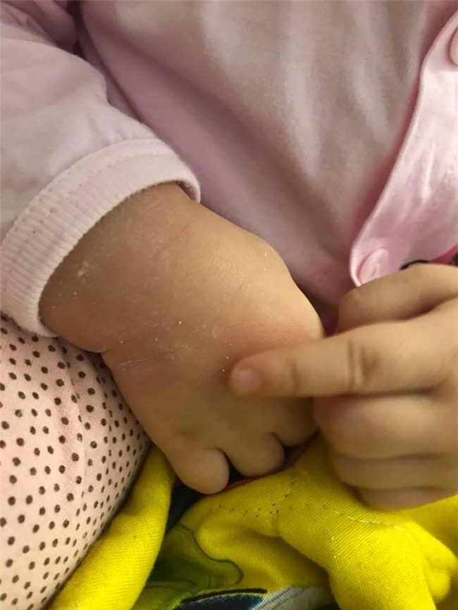 Hồng Quế tự trách móc bản thân vì một phút lơ là khiến con bị bỏng - Ảnh 2.