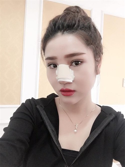 con sot lam dep mang ten "sua mui" dang lan rong den muc nao? - 8