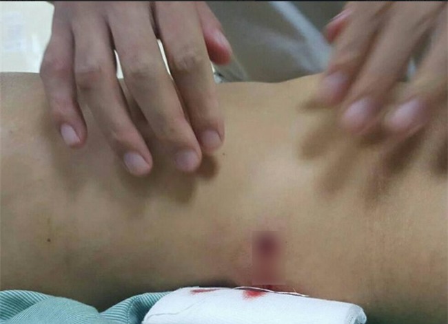 Cô gái bị đạn lạc bắn thủng bụng ngay trên đường ở Hà Nội - Ảnh 3.