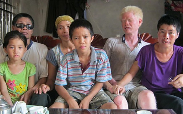 cau chuyen ve “tinh chi, duyen em” cam dong cua nguoi thuong binh mu loa - 2