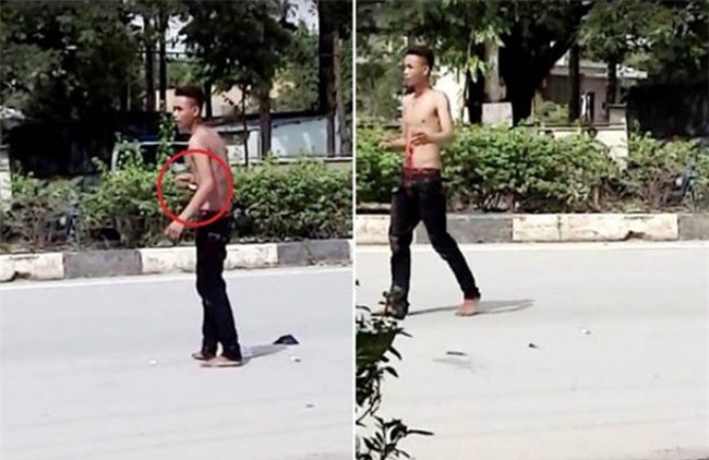 Nam thanh niên nghi “ngáo đá” tự đâm xổ ruột giữa đường - Ảnh 1.