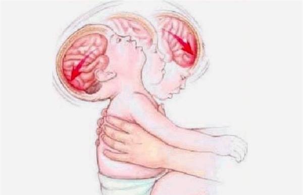 nao tre bi anh huong nghiem trong the nao khi bi rung lac, quang quat? - 2