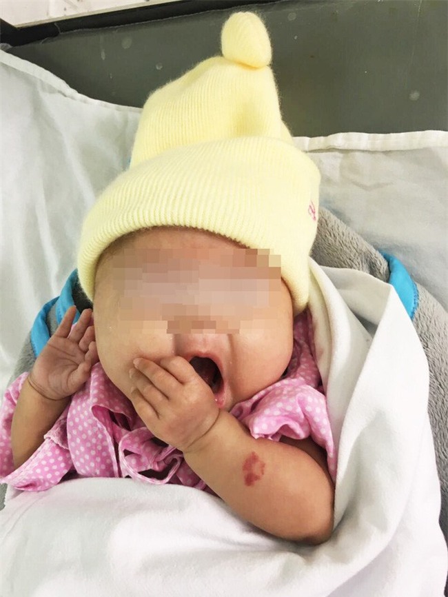 Đôi vợ chồng hiếm muộn vỡ òa khi con gái sinh ra chỉ 24 tuần tuổi, nặng 660 gram được cứu khỏi tử thần - Ảnh 5.