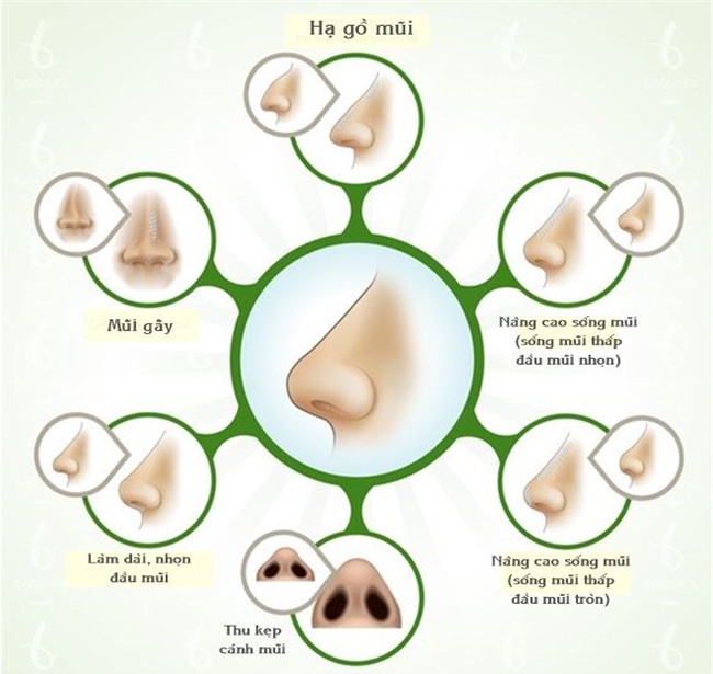 nang mui khong can cham dao keo: day la phuong phap lam mui hot nhat hien tai! - 4