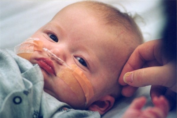 tre bi viem phoi co duoc tam khong? - 1