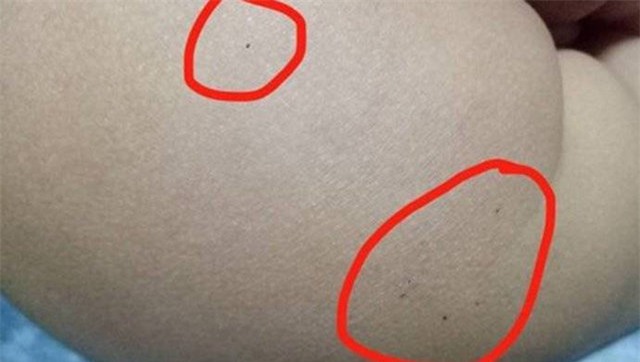 chan dong: nghi an nhieu tre o truong mam non noi tieng tq bi co giao tiem thuoc ngu - 4