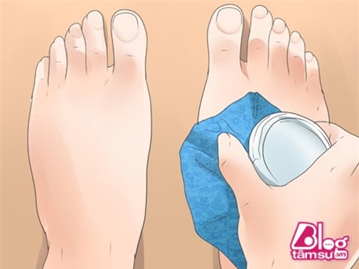 giam-phu-chan-khi-mang-thai-voi-nhung-meo-hay-don-gian-de-lam-6