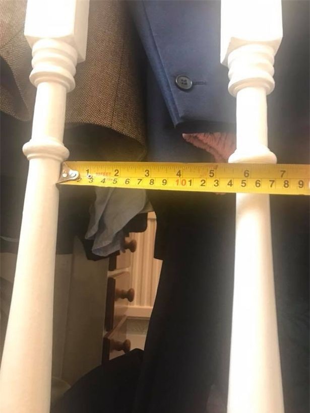 Bé gái vỡ xương sọ vì “sát thủ thầm lặng” trong nhà mà ít bố mẹ nào để ý đến - Ảnh 2.