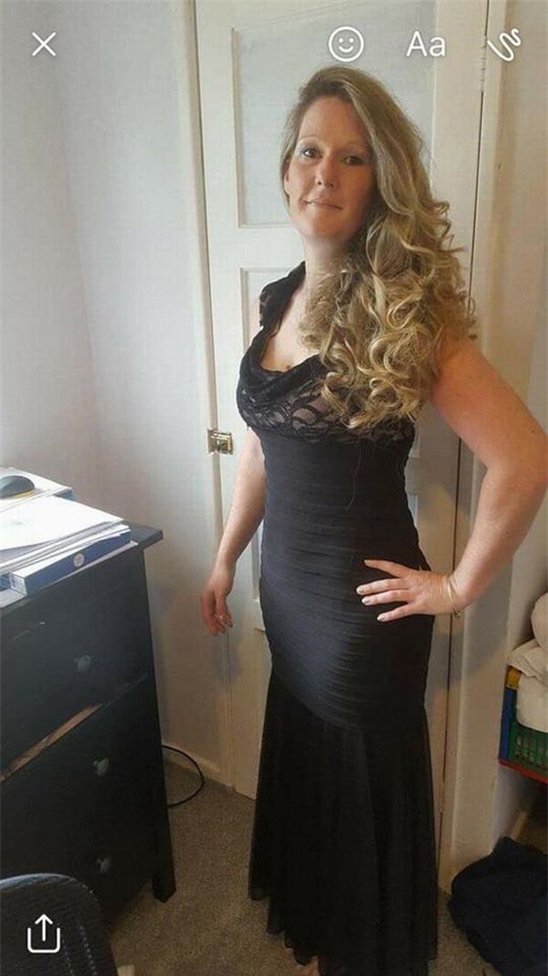 tu nguoi co than hinh dep, co gai phai chiu hau qua nang ne vi sai lam cua bac si - 3