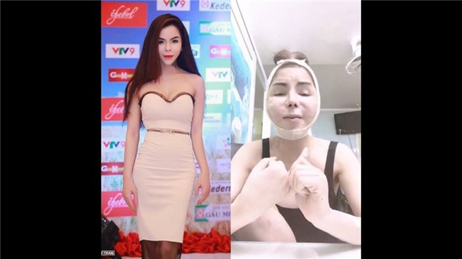 Phát hoảng với gương mặt biến dạng khủng khiếp sau thẩm mỹ của hot girl chuyển giới Linda-5