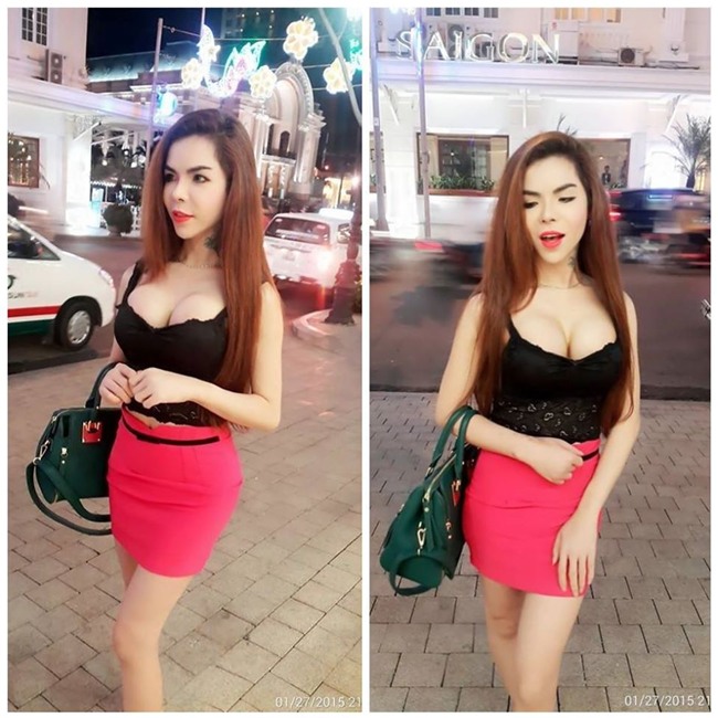 Phát hoảng với gương mặt biến dạng khủng khiếp sau thẩm mỹ của hot girl chuyển giới Linda-7