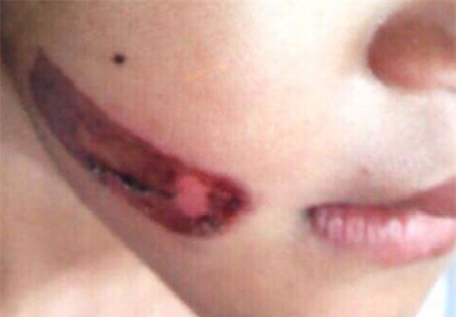 Bạo hành trẻ em,Kiên Giang