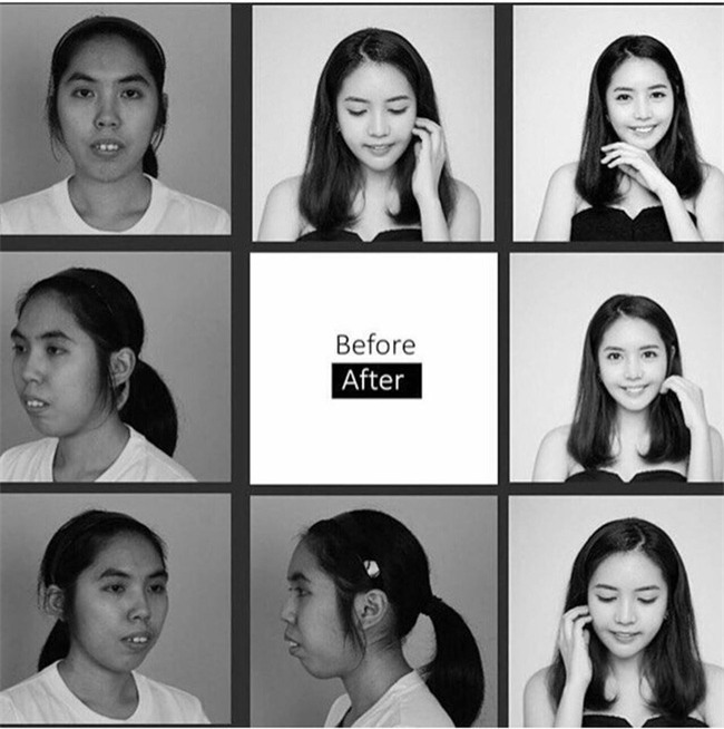 Liên tục bị từ chối khi xin việc, cô gái có khuôn mặt xấu xí biến đổi bất ngờ sau thẩm mỹ-3