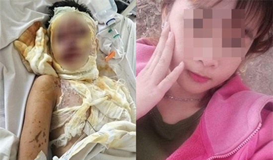 Hàn gắn tình cảm bất thành, thuê người tạt axit 2 thiếu nữ - Ảnh 1.