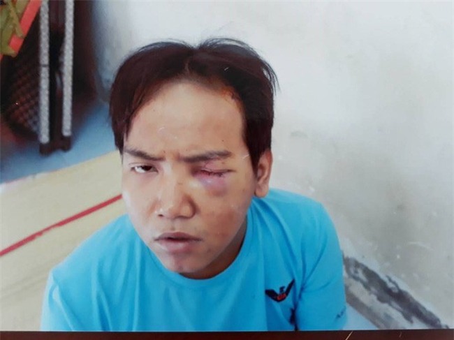 Từng bị bệnh tâm thần phân liệt, bảo vệ dân phố sát hại bé 6 tuổi ở Sài Gòn sẽ bị xử lý thế nào? - Ảnh 1.