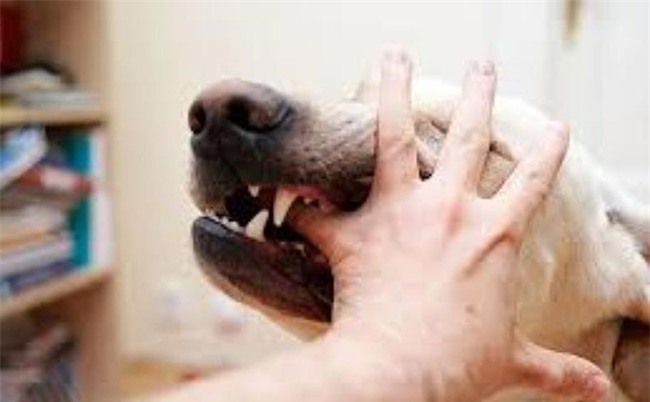 Mất 2 chân vì vết chó cắn từ 2 năm trước