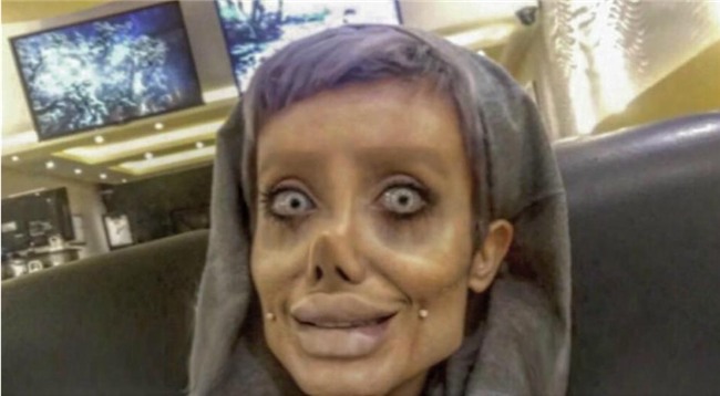 Cô gái phẫu thuật thẩm mỹ hơn 50 lần đề nhìn giống Angelina Jolie, kết quả trả về gia tinh Dobby - Ảnh 2.