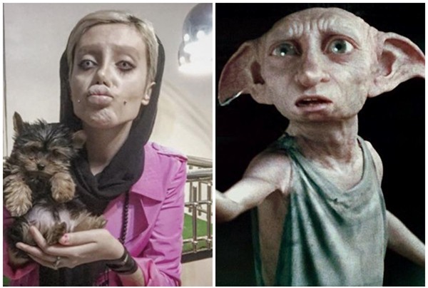 Cô gái phẫu thuật thẩm mỹ hơn 50 lần đề nhìn giống Angelina Jolie, kết quả trả về gia tinh Dobby - Ảnh 5.