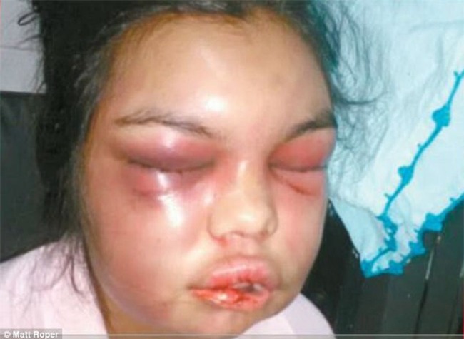 Người phụ nữ bị chồng đấm mỗi khi có ai đó like ảnh của cô trên facebook - Ảnh 2.