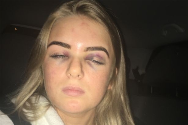 Cô gái 19 tuổi cố gắng thoát thân sau khi bị bạn trai lột sạch quần áo và đánh đập tàn nhẫn - Ảnh 2.