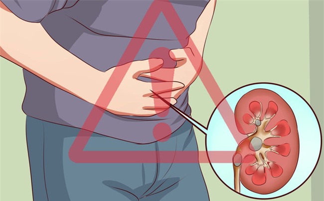 Đây là những hành động phá hủy thận từng ngày có thể bạn vô tình mắc mà không biết