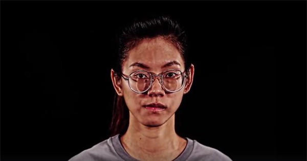 Cô gái hàm lệch, miệng méo thay đổi ấn tượng sau thẩm mỹ khiến mẹ đẻ khóc nghẹn vì xúc động-1