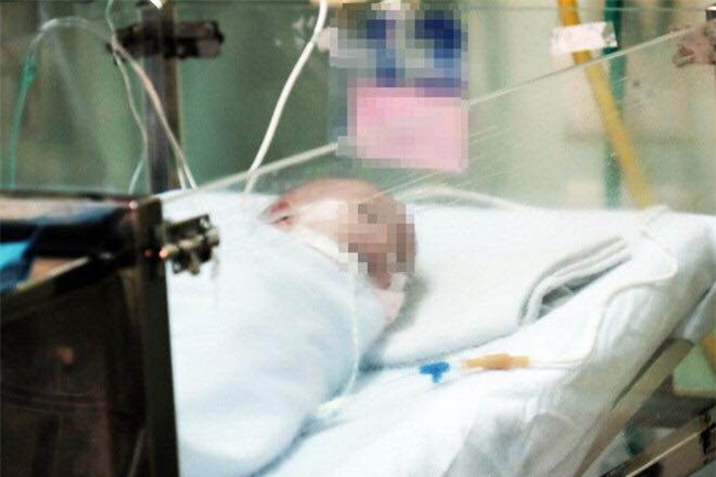 be gai sinh non o tuan 24 thai ky, chi nang 660 gram thoat khoi luoi hai “tu than” - 1