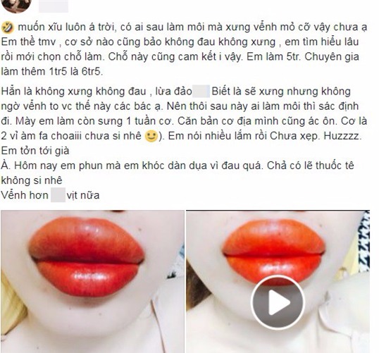 Thẩm mỹ viện quảng cáo phun môi không sưng không đau, cô gái trẻ háo hức đi làm và cái kết đắng ngắt - Ảnh 2.